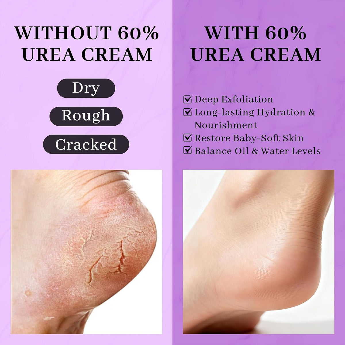 5-in-1 60% Urea Cream for Feet & 2% Salicylic Acid for Deep Hydration-150g
