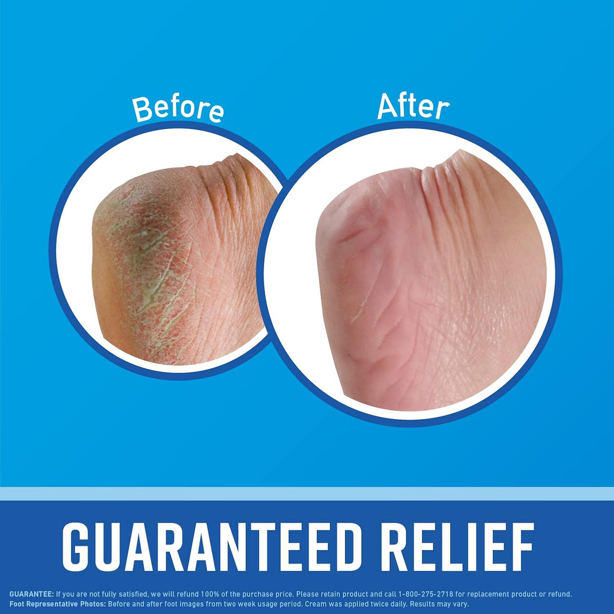 O'Keeffe's Working Hands Hand Cream (3 oz Tube) and Healthy Feet Foot Cream (3 oz Tube) - Repairing Skincare for Extremely Dry, Cracked Hands and Feet, Travel Size