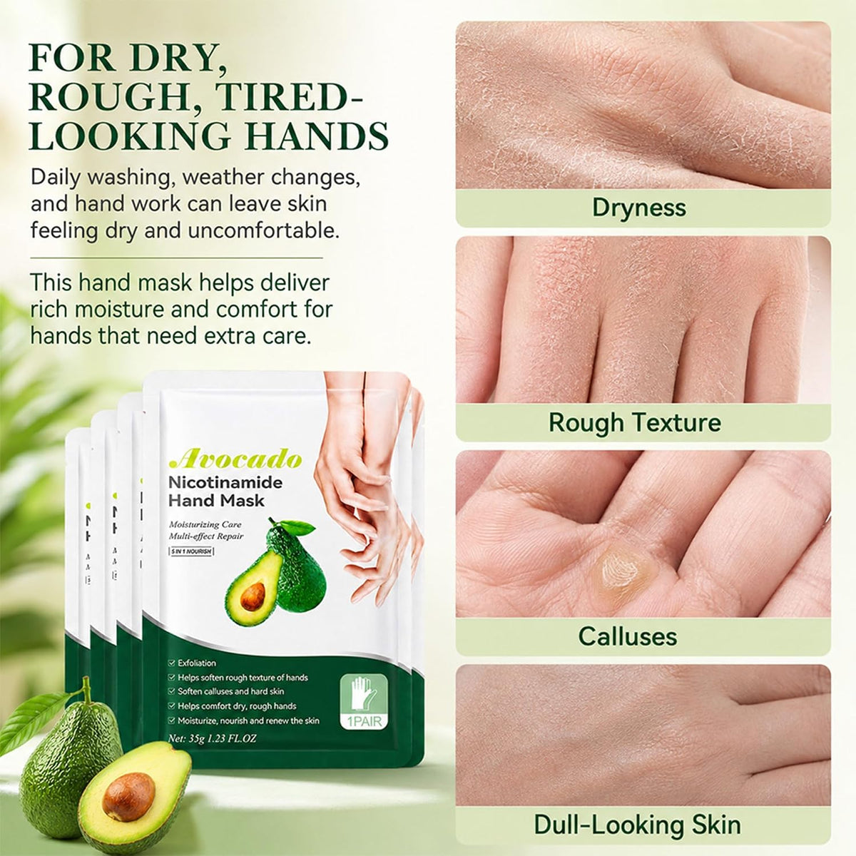 Avocado Hand Masks Moisturizing Glove, 5 Pairs Hand Peeling Mask