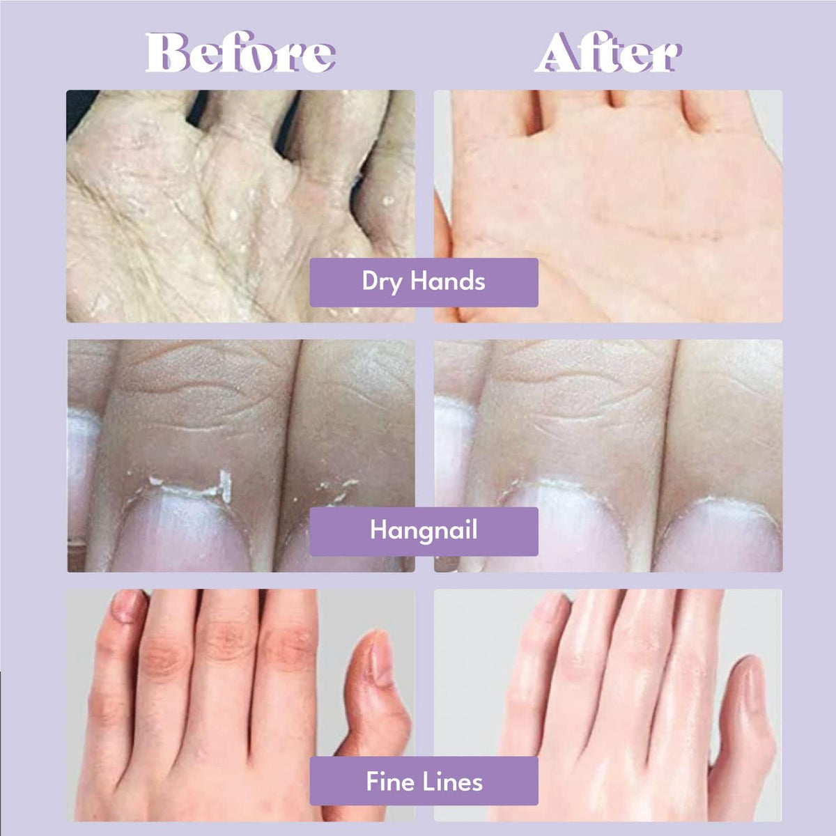 TOI:L Catherine Muller Floral Hand Mask 1 Pair, Moisturizing Gloves for Dry Hands with Elder Flower & CICA, Repairing and Nourishing Hand Care Treatment for Cracked, Rough, and Dry Skin
