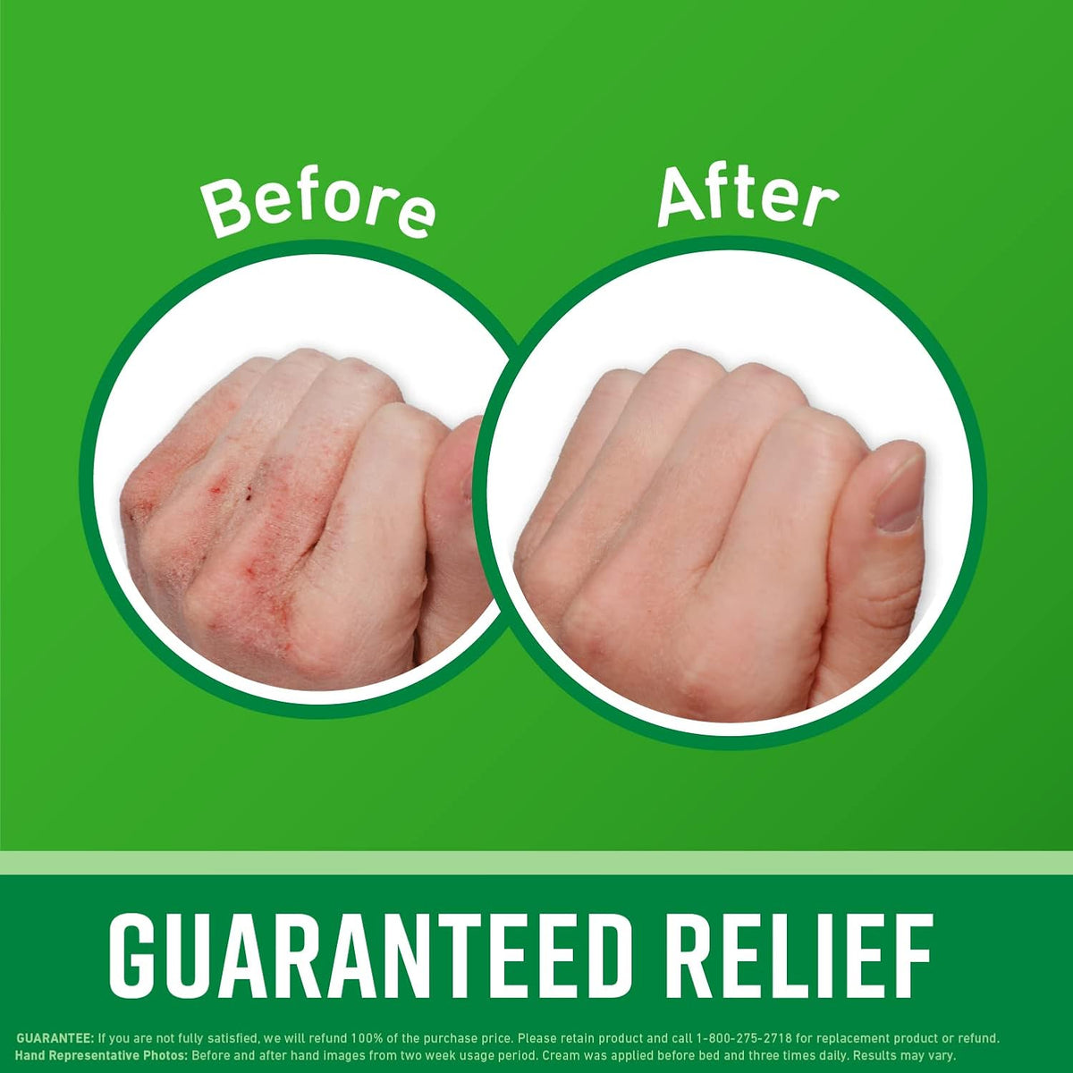 O'Keeffe's Working Hands Hand Cream (3.4 oz Jar) and Healthy Feet Foot Cream (3.2 oz Jar) - Repairing Skincare for Extremely Dry, Cracked Hands and Feet, Travel Size