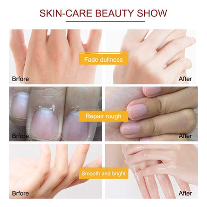 ZIXAOK 5 Pairs Hand Mask Gloves, Hand Moisturizing & Repairing Treatment