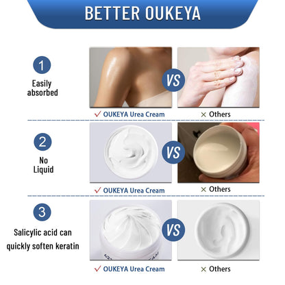 OUKEYA Urea Cream 42% to Soften & Smooth Dry, Cracked, Rough Skin