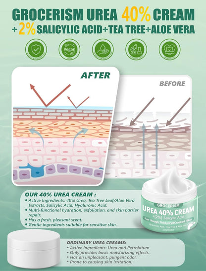 Grocerism Urea Cream 40% for Feet Maximum Strength Hand & Foot Cream 5.29oz