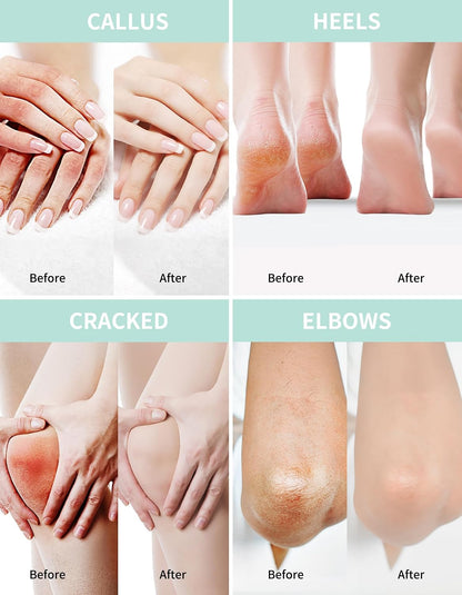 Grocerism Urea Cream 40% for Feet Maximum Strength Hand & Foot Cream 8.82oz