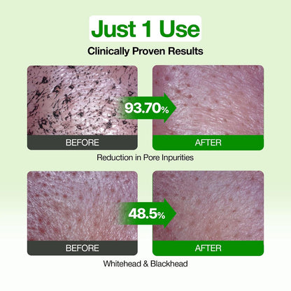 FULLY Green Tomato Pore Clay Mask Cleanser for Deep Cleansing, 4.05 fl oz