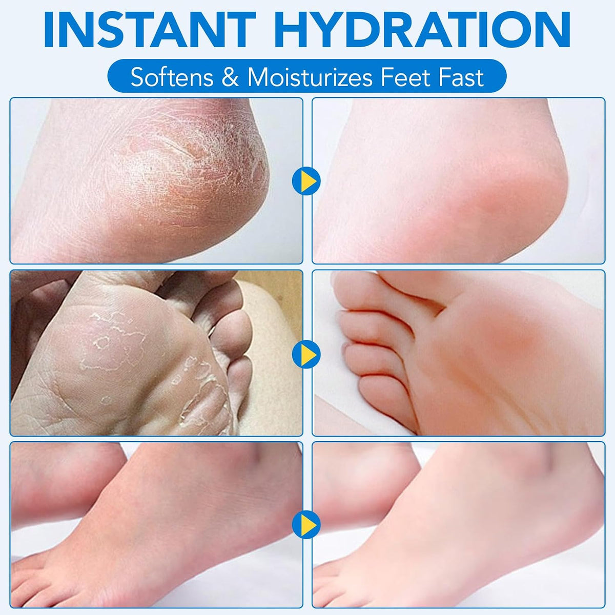 Uruses 2Pack Urea Cream 60% plus Salicylic Acid 2% Urea Foot Care Stick,Foot Cream for Foot Callus Remover, Feet Moisturizer Stick for Dry Cracked Heels, Hands, Knees,Hydrating Heel Balm, Easy To Use