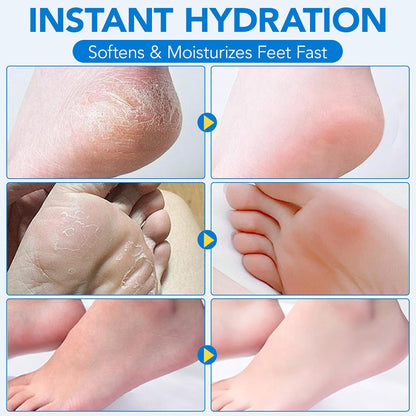 Uruses 2Pack Urea Cream 60% plus Salicylic Acid 2% Urea Foot Care Stick,Foot Cream for Foot Callus Remover, Feet Moisturizer Stick for Dry Cracked Heels, Hands, Knees,Hydrating Heel Balm, Easy To Use