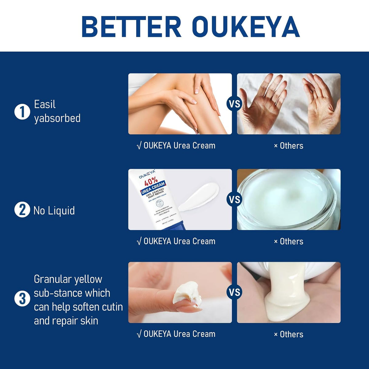 OUKEYA Urea Cream 40%, Foot & Hand Lotion for Dry Cracked Rough Skin
