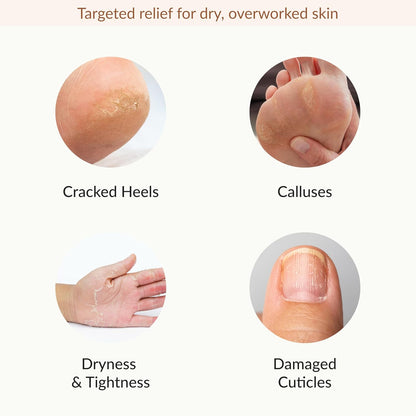 Epielle Hydrating & Moisturizing Hand & Foot Masks, Relieve and Soften Dry, Rough Skin, Self Care Gifts for Women, Spa Kit, 6 Moisturizing Gloves & 6 Moisturizing Socks