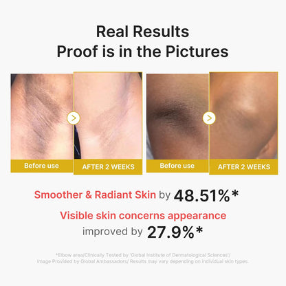 medicube Body Peel Shot with Kojic Acid and Turmeric