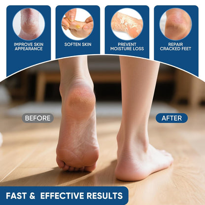 Urea Cream 40 Percent with 2% Salicylic Acid, Urea Cream 40 Percent for Feet Maximum Strength, Foot & Hand Cream for Dry Cracked Heels, Callus Softener for Rough Thick Skin, 5.29 oz