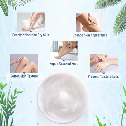 OUKEYA 40 Percent Urea Cream Hand Foot Cream for Dry Cracked Skin