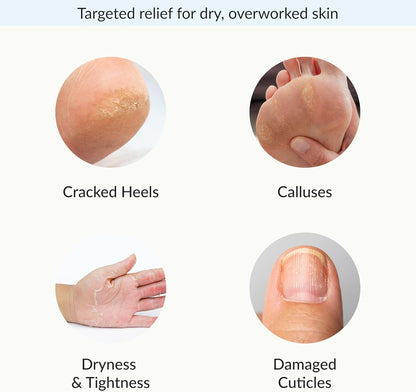 Epielle Intensive Repairing Hand & Foot Masks, Restore and Moisturize Dry, Cracked Skin, Self Care Gifts for Women, Spa Kit, 6 Moisturizing Gloves & 6 Moisturizing Socks