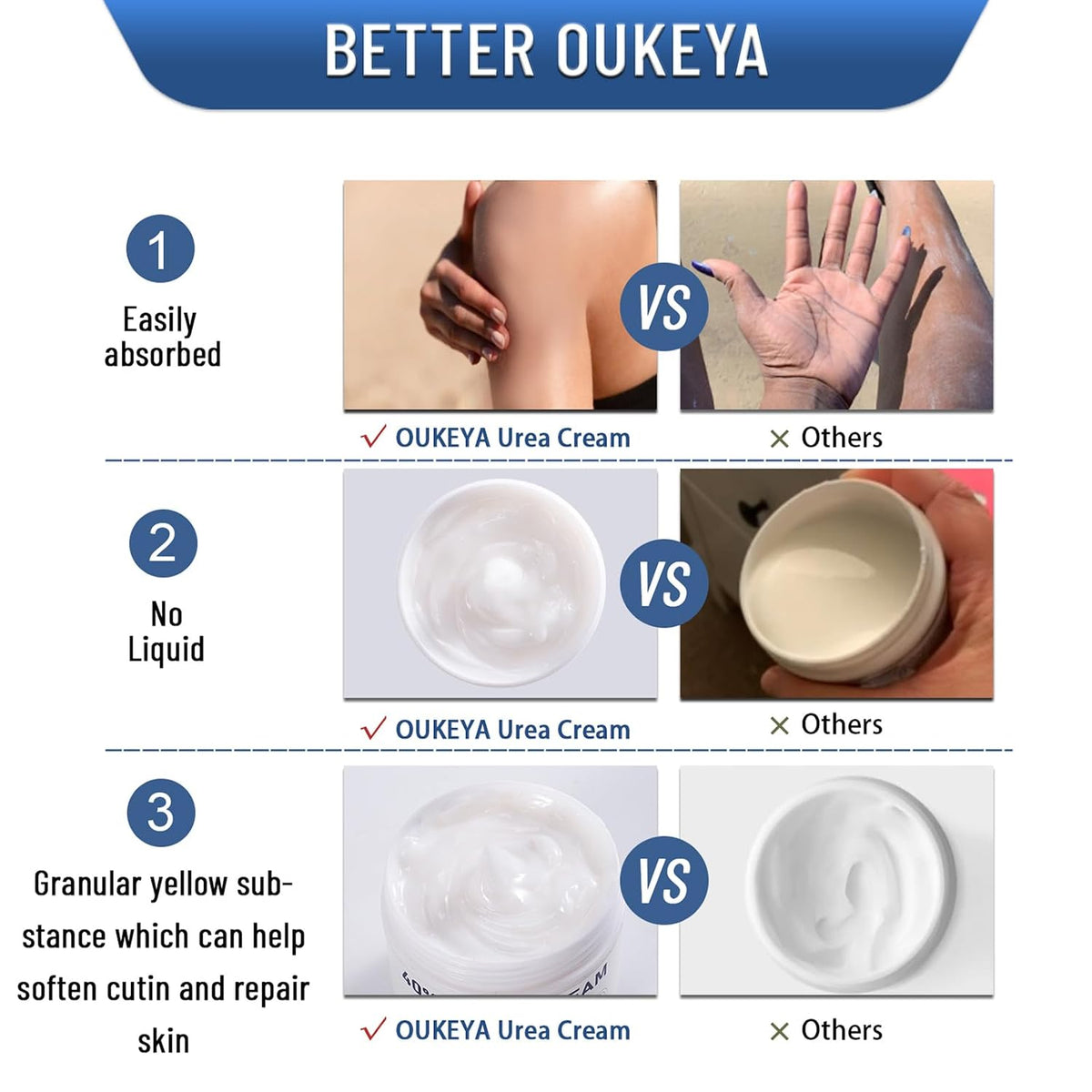 OUKEYA 40 Percent Urea Cream Hand Foot Cream for Dry Cracked Skin