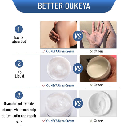 OUKEYA 40 Percent Urea Cream Hand Foot Cream for Dry Cracked Skin