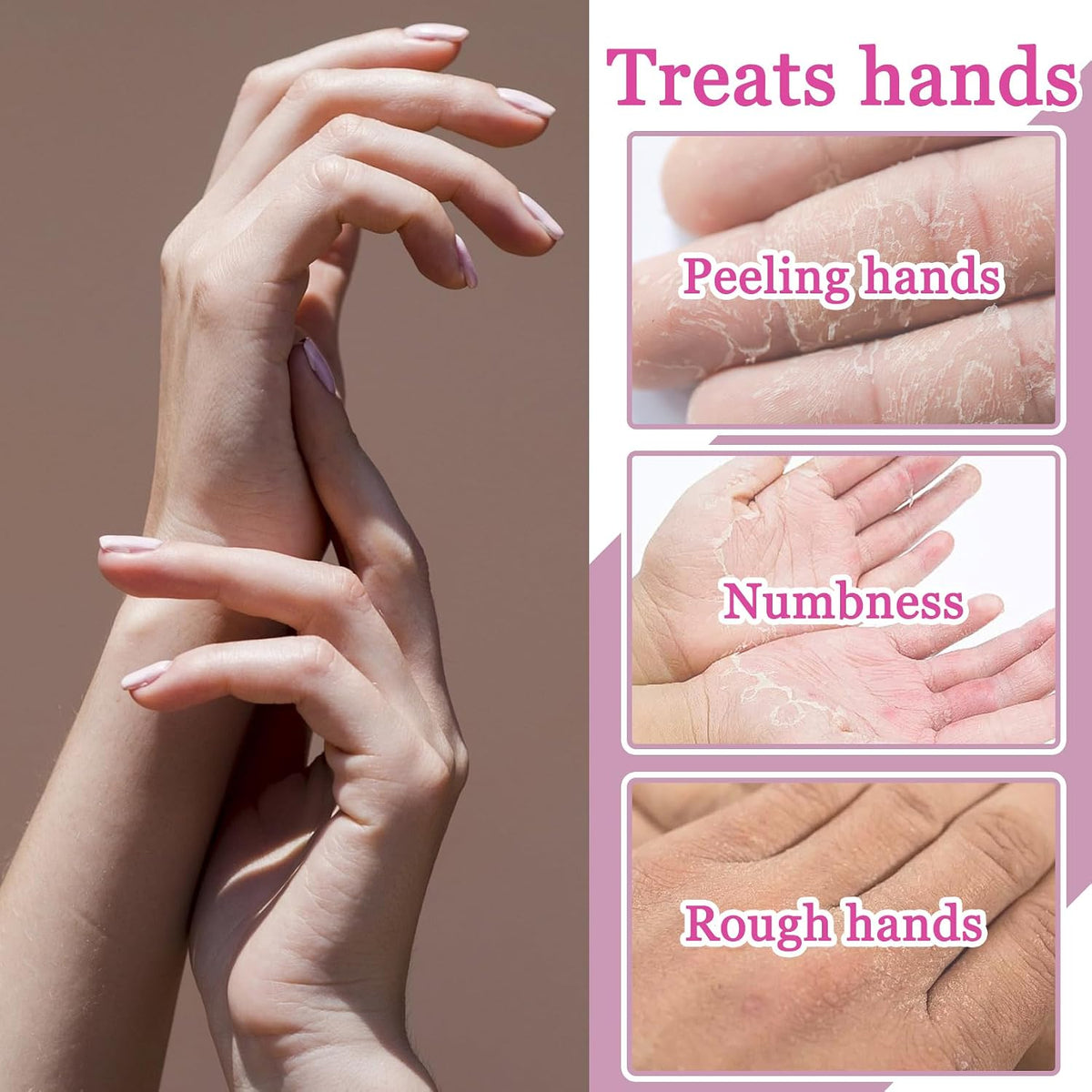 Hydrating Hand Masks, 6PCS Hand Mask Moisturizing Gloves for Men Women, Smooth Long Lasting Soft Exfoliating Hand Peeling Spa Mask Moisturizer Beauty Gift Set for Dry Cracked Rough Dull Hands（A)