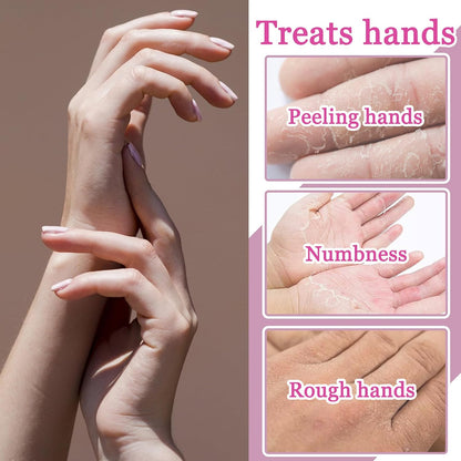 Hydrating Hand Masks, 6PCS Hand Mask Moisturizing Gloves for Men Women, Smooth Long Lasting Soft Exfoliating Hand Peeling Spa Mask Moisturizer Beauty Gift Set for Dry Cracked Rough Dull Hands（A)