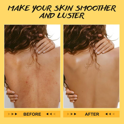Turmeric Vitamin C Body Scrub Remove Dead Skin Exfoliating for Dark Spots