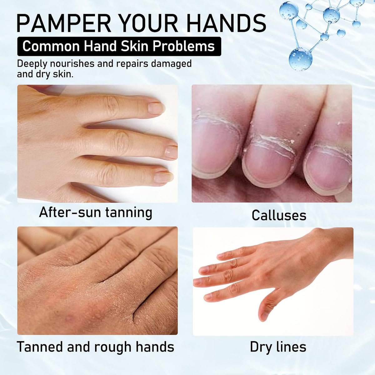 6PCS Moisturizing Hand Masks,Deep Nourishing Hand Gloves,Hydrating Hand Mask for Dry Cracked Hands,Soft and Smooth Touch Hands,Self Care Gifts for Women