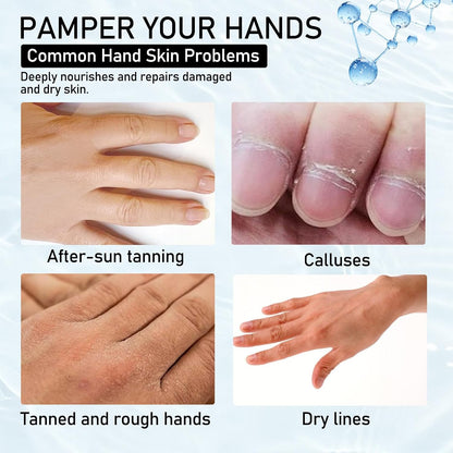 6PCS Moisturizing Hand Masks,Deep Nourishing Hand Gloves,Hydrating Hand Mask for Dry Cracked Hands,Soft and Smooth Touch Hands,Self Care Gifts for Women