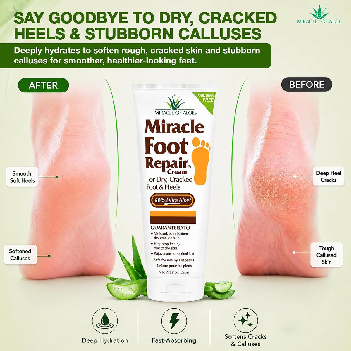 Miracle of Aloe - 8oz Foot Repair Cream + 1oz Hand Repair Cream