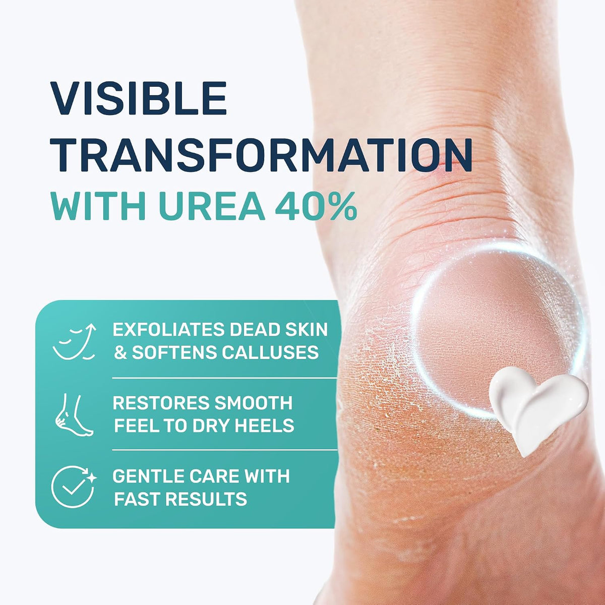 Urea Cream 40 Percent for Feet Maximum Strength - Urea Foot Cream and Callus Remover, Exfoliating Heels Cream with Salicylic Acid - Dry Cracked Foot Lotion Urea, Ceramides, Tea Tree Oil, 4.3 oz