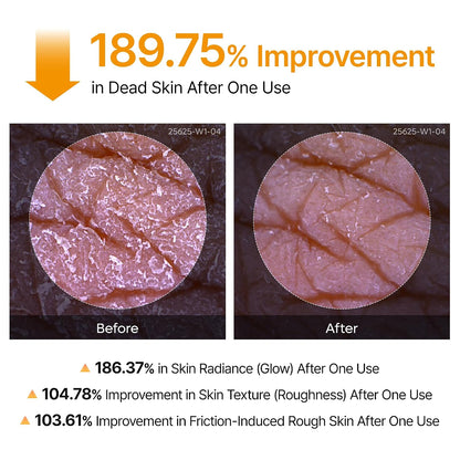 Dr.Melaxin Peel Shot Kojic Acid Turmeric Body Exfoliator Spray 6.76 fl.oz - AHA PHA Niacinamide Body Scrub for KP Bumps, Dark Spots, Uneven Skin Tone, Dead Skin, Korean Skin Care