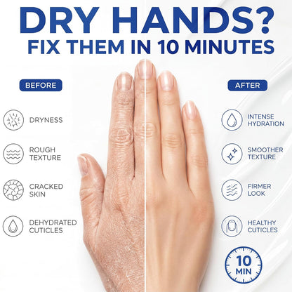 Hand Mask – Moisturizing Gloves for Dry Cracked Hands, Deep Collagen Care