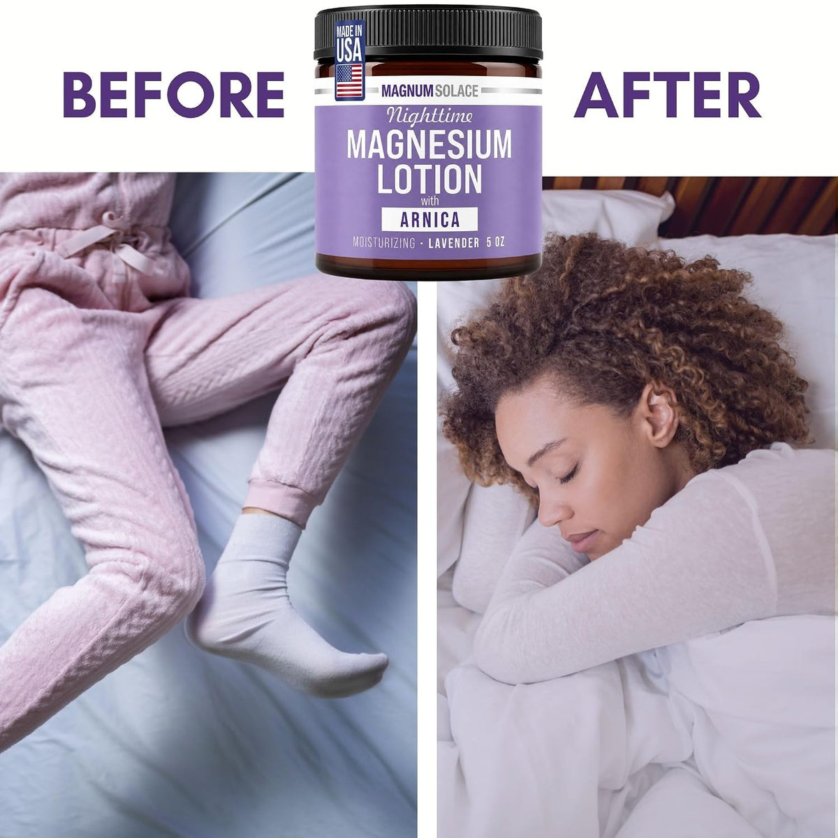 Magnum Solace Nighttime Magnesium Lotion with Arnica – Highly Concentrated Magnesium for Muscles & Joints – Apply to Legs or Feet Before Bed – Skin-Friendly